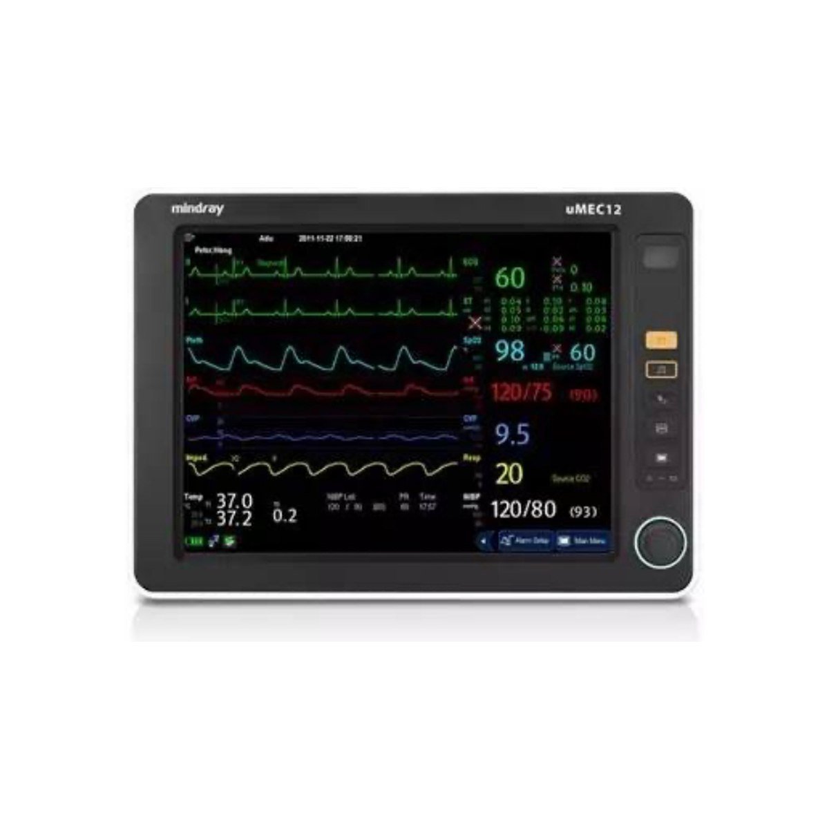 Monitor de signos vitales con capnografía uMEC12