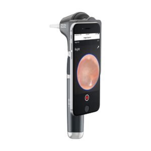 Otoscopio Macroview Plus LED