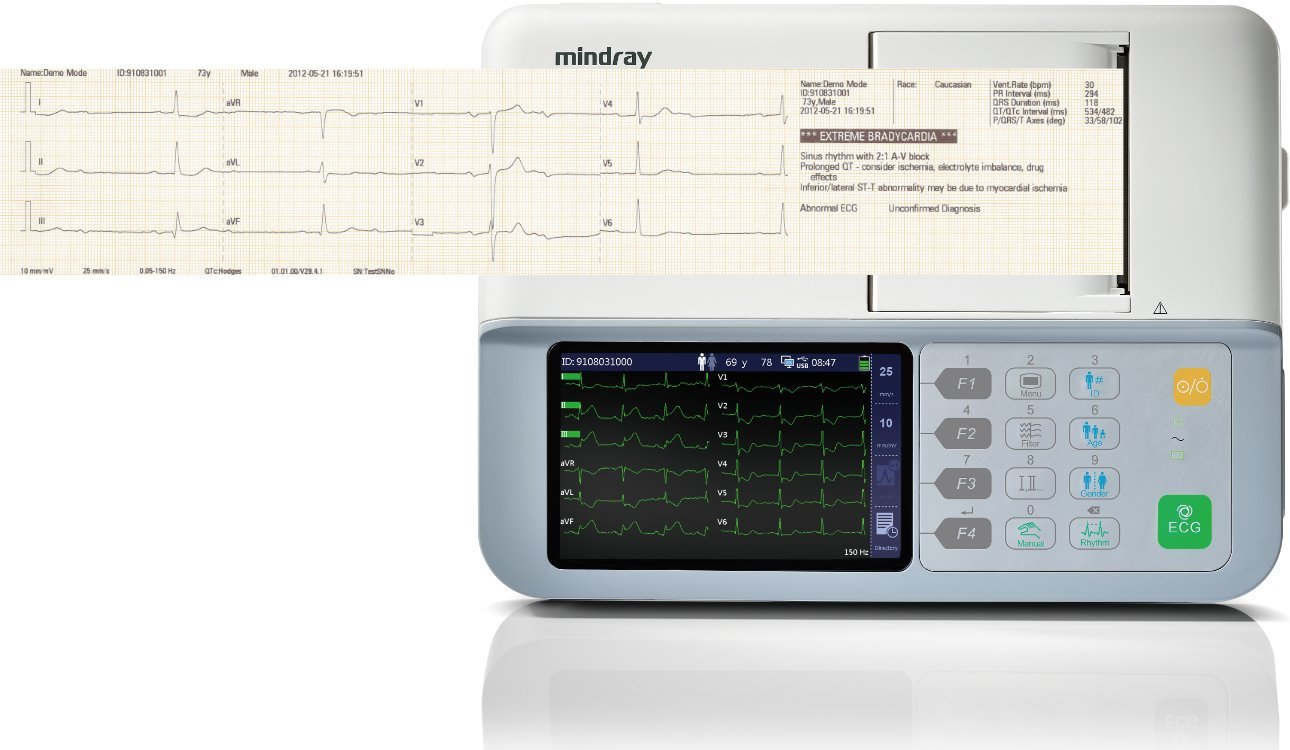 Electrocardiógrafo de 3 canales