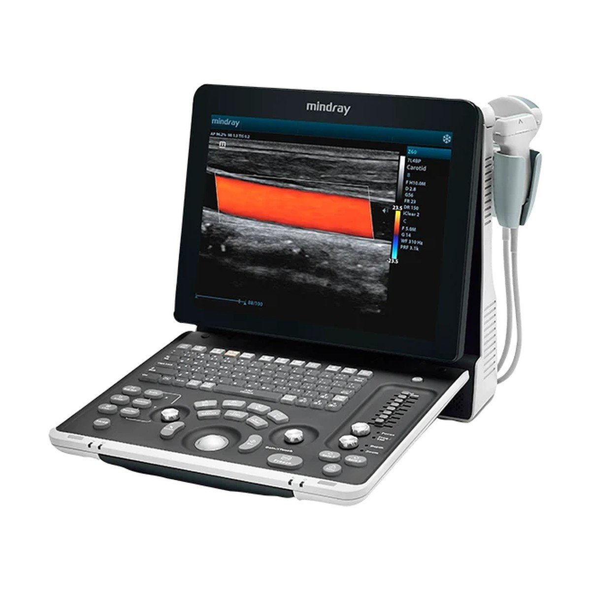 SISTEMA DE ULTRASONIDO DIAGNOSTICO PORTATIL CON DOPPLER COLOR Z60VET. ESCANEO ININTERRUMPIDO DE 1.5HRS MONITOR DE 15" ANGULABLE A 60° MEMORIA DE 500GB. INCLUYE BATERIA RECARGABLE